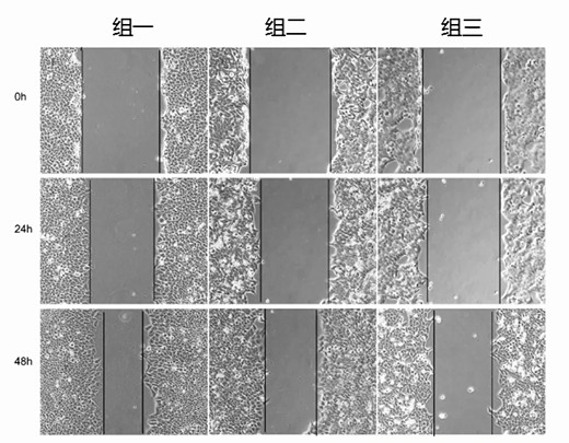 细胞划痕实验